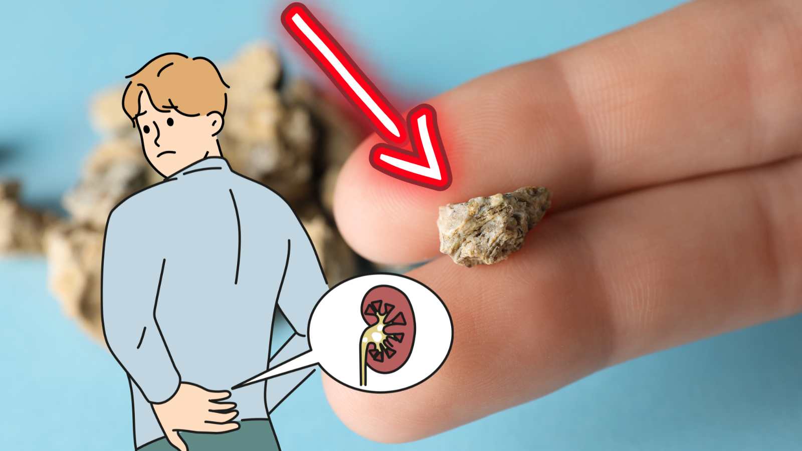 will kidney stone pass on its own